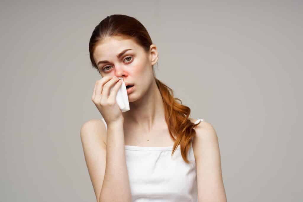 young woman holding tissue with allergy