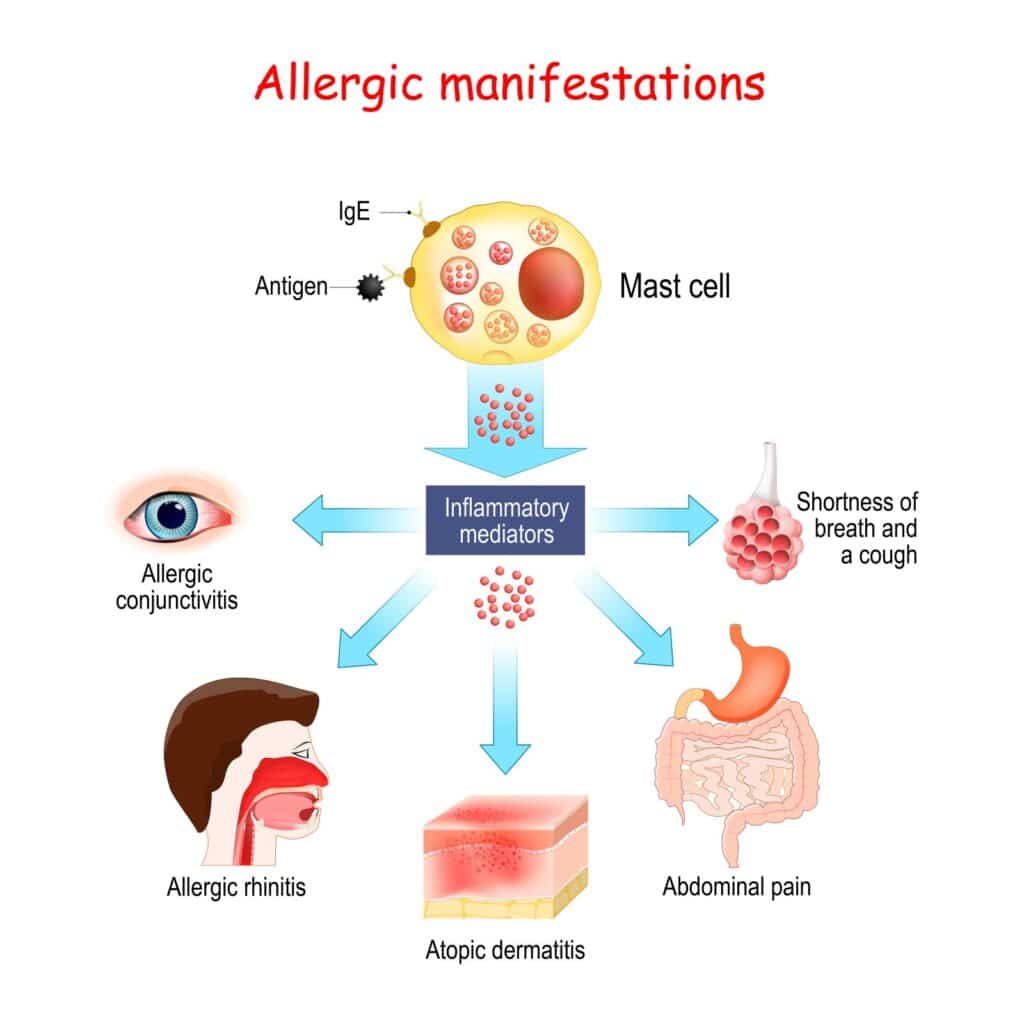 allergic manifestations vector
