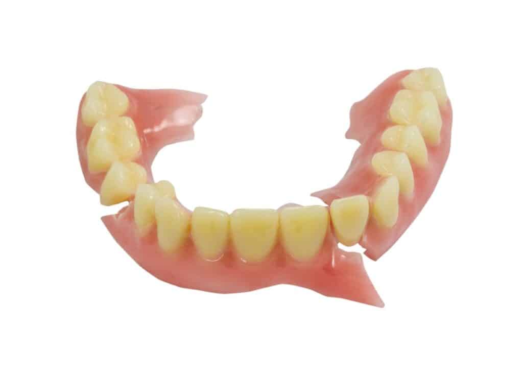 A broken lower denture showing cracked acrylic base and missing pieces, illustrating common denture breakages and need for repairs in Te Awamutu.